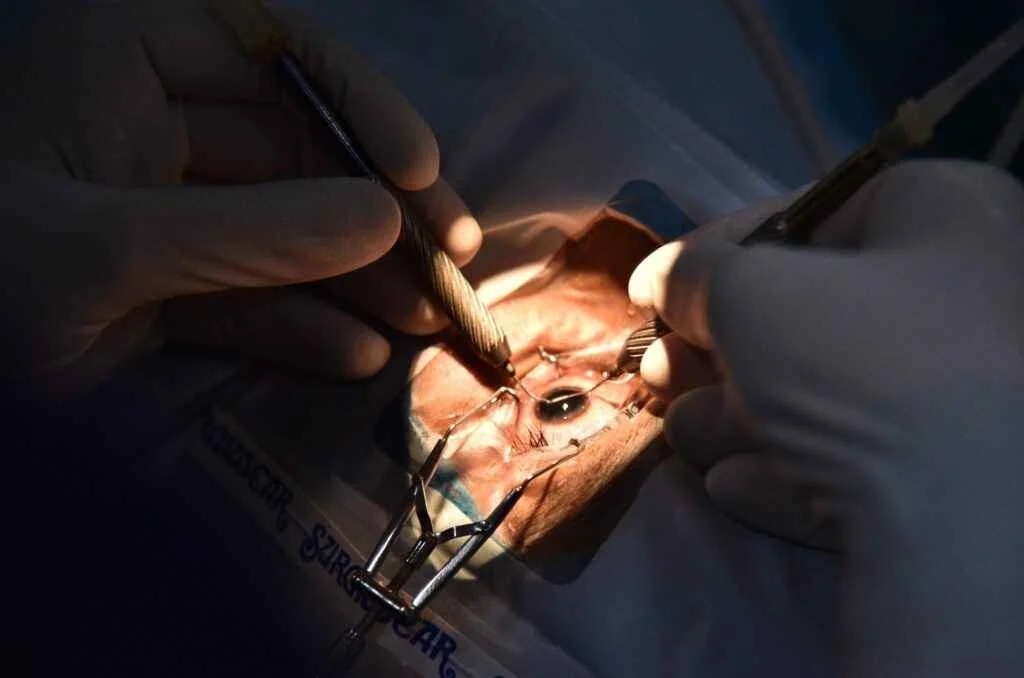 Cataract Surgery Clinic in Bardhaman