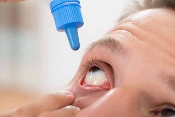 Glaucoma Treatment